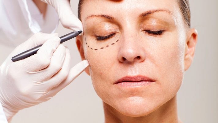 mulher-sendo-preparada-para-cirurgia-plastica-nas-palpebras-1384467200554_1920x1080 mulher-sendo-preparada-para-cirurgia-plastica-nas-palpebras-1384467200554_1920x1080